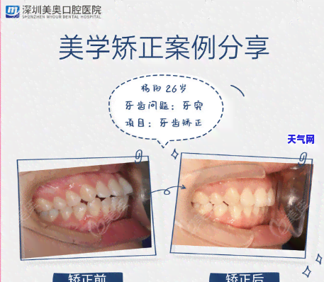 翡翠色料对半切的影响有哪些？深度解析影响因素与结果