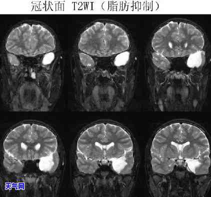 翡翠的蛛网裂值钱吗，探究翡翠蛛网裂的价值：是否值得收藏投资？